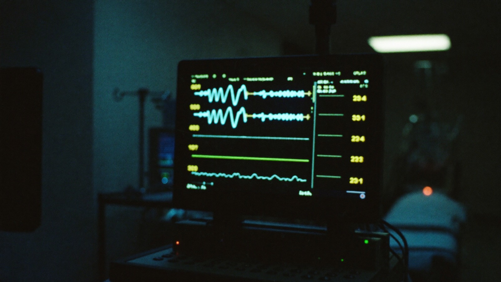 Monitor multiparâmetro com curvas de ECG, SpO₂ e capnografia brilhando numa sala cirúrgica escura, leito ao fundo